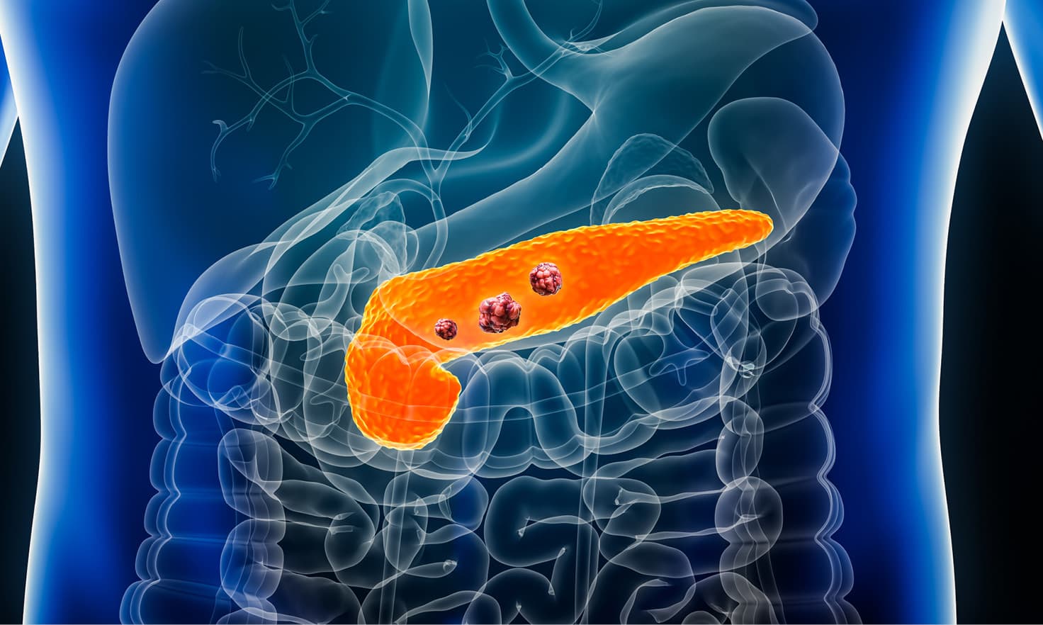 Pancreatic Surgery - HPB Surgery Service
