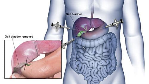 Emergency & Complex Abdominal Surgery - HPB Surgery Service